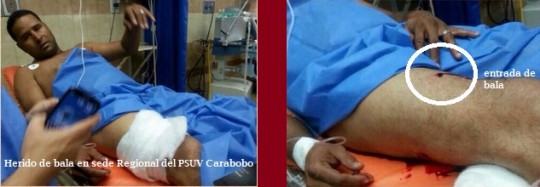 Herido de Bala PSUV Carabobo